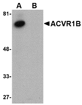 ACVR1B / ALK4 Antibody - Western blot of ACVR1B in human kidney tissue lysate with ACVR1B antibody at 1 ug/ml in (A) the absence and (B) the presence of blocking peptide.