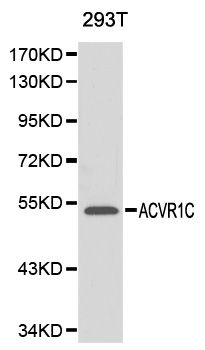 ACVR1C / ALK7 Antibody - Western blot analysis of 293T cell lysate using ACVR1C antibody.
