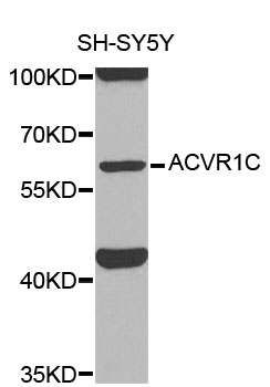 ACVR1C / ALK7 Antibody - Western blot analysis of extracts of SH-SY5Y cells, using ACVR1C antibody at 1:1000 dilution. The secondary antibody used was an HRP Goat Anti-Rabbit IgG (H+L) at 1:10000 dilution. Lysates were loaded 25ug per lane and 3% nonfat dry milk in TBST was used for blocking. An ECL Kit was used for detection and the exposure time was 90s.