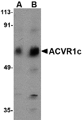 ACVR1C / ALK7 Antibody - Western blot of ACVR1C in human placenta tissue lysate with ACVR1C antibody at (A) 1 and (B) 2 ug/ml.