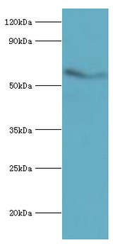 ACVR2 / ACVR2A Antibody - Western blot. All lanes: Activin receptor type-2A antibody at 3 ug/ml+mouse brain tissue. Secondary antibody: Goat polyclonal to rabbit at 1:10000 dilution. Predicted band size: 58 kDa. Observed band size: 58 kDa.