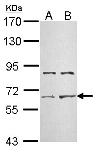 ACVR2 / ACVR2A Antibody - Sample (30 ug of whole cell lysate). A: Hela, B: Hep G2 . 7.5% SDS PAGE. ACVR2 / ACVR2A antibody diluted at 1:10000.