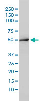 ACY1 / Aminoacylase 1 Antibody - Western blot of ACY1 expression in K-562 by ACY1 monoclonal antibody (M01), clone 4F1-B7.
