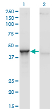 ACY1 / Aminoacylase 1 Antibody - Western blot of ACY1 expression in transfected 293T cell line by ACY1 monoclonal antibody (M01), clone 4F1-B7.