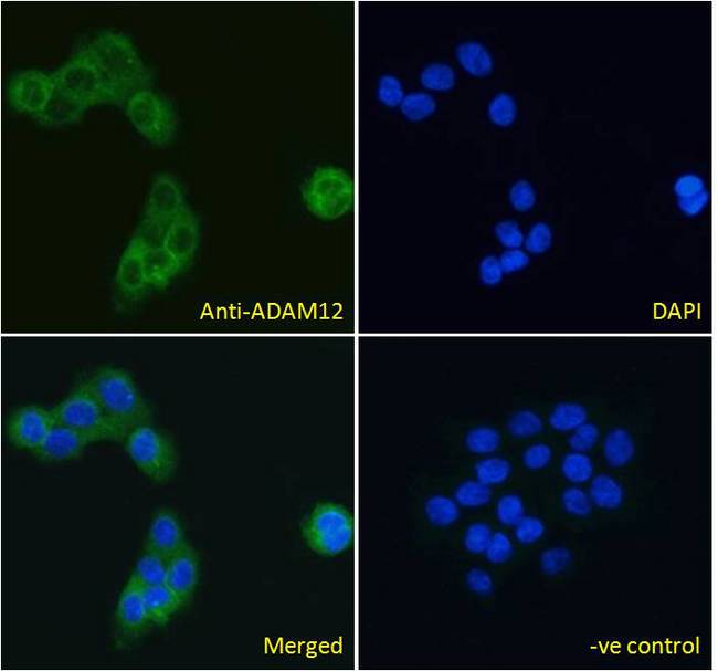 ADAM12 Antibody - ADAM12 antibody immunofluorescence analysis of paraformaldehyde fixed A431 cells, permeabilized with 0.15% Triton. Primary incubation 1hr (10ug/ml) followed by Alexa Fluor 488 secondary antibody (4ug/ml), showing cytoplasmic/plasma membrane staining. The nuclear stain is DAPI (blue). Negative control: Unimmunized goat IgG (10ug/ml) followed by Alexa Fluor 488 secondary antibody (4ug/ml).