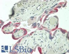 ADAM12 Antibody - Human Placenta: Formalin-Fixed, Paraffin-Embedded (FFPE)