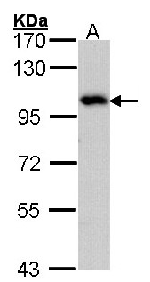 ADAM15 Antibody - Sample (30 ug of whole cell lysate). A: Hep G2. 7.5% SDS PAGE. ADAM15 antibody diluted at 1:1000. 