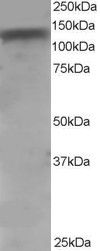 ADAM17 / TACE Antibody - HeLa lysate (RIPA buffer, 35 ug total protein per lane). Primary incubated for 1 hour. Detected by Western blot of chemiluminescence.