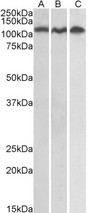 ADAM17 / TACE Antibody - ADAM17 / TACE antibody staining (0.3ug/ml) of Daudi (A), Jurkat (B) and HeLa (C) lysates (35ug total protein in RIPA buffer). Detected by chemiluminescence.