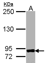 ADAM8 Antibody - Sample(30 g of whole cell lysate). A: Raji. 7.5% SDS PAGE. ADAM8 antibody diluted at 1:500.