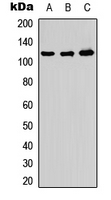 ADAMTS10 Antibody - Western blot analysis of ADAMTS10 expression in HeLa (A); PC12 (B); Raw264.7 (C) whole cell lysates.