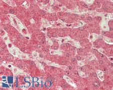 ADAMTS13 Antibody - Human Liver: Formalin-Fixed, Paraffin-Embedded (FFPE)