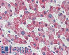 ADAMTS13 Antibody - Human Liver: Formalin-Fixed, Paraffin-Embedded (FFPE)