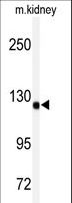ADAMTS19 Antibody - Western blot of anti-ADAMTS19 Antibody in mouse kidney tissue lysates (35 ug/lane). ADAMTS19 (arrow) was detected using the purified antibody.