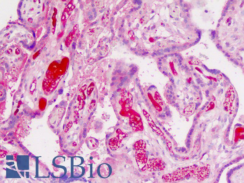 ADAMTS19 Antibody - Human Placenta: Formalin-Fixed, Paraffin-Embedded (FFPE)
