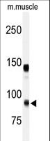 ADAMTS5 Antibody - Western blot of anti-ADAMTS5 Antibody in mouse muscle tissue lysates (35 ug/lane). ADAMTS5(arrow) was detected using the purified antibody.