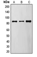 ADAP / FYB Antibody - Western blot analysis of FYB expression in A549 (A); MDAMB435 (B); TF1 (C) whole cell lysates.