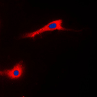 ADCK3 / CABC1 Antibody - Immunofluorescent analysis of CABC1 staining in HeLa cells. Formalin-fixed cells were permeabilized with 0.1% Triton X-100 in TBS for 5-10 minutes and blocked with 3% BSA-PBS for 30 minutes at room temperature. Cells were probed with the primary antibody in 3% BSA-PBS and incubated overnight at 4 C in a humidified chamber. Cells were washed with PBST and incubated with a DyLight 594-conjugated secondary antibody (red) in PBS at room temperature in the dark. DAPI was used to stain the cell nuclei (blue).