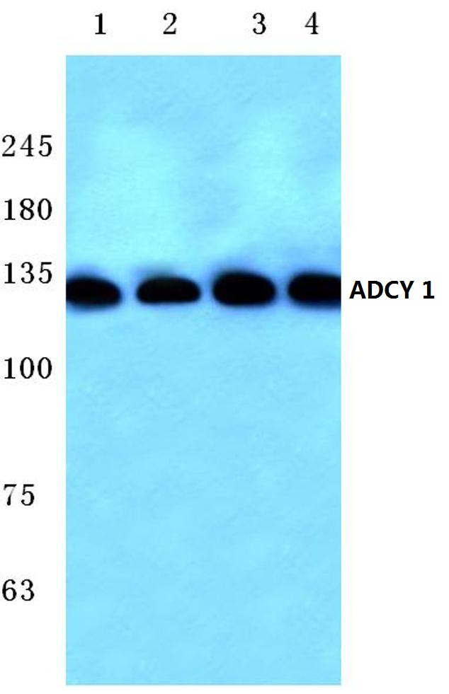 ADCY1 / Adenylate Cyclase 1 Antibody - Western blot analysis of Anti-ADCY1 pAb at 1:500 dilution. Lane 1: Hela cell lysate. Lane 2: HEK293T cell lysate. Lane 3: Mouse liver tissue lysate. Lane 4: Rat kidney tissue lysate.