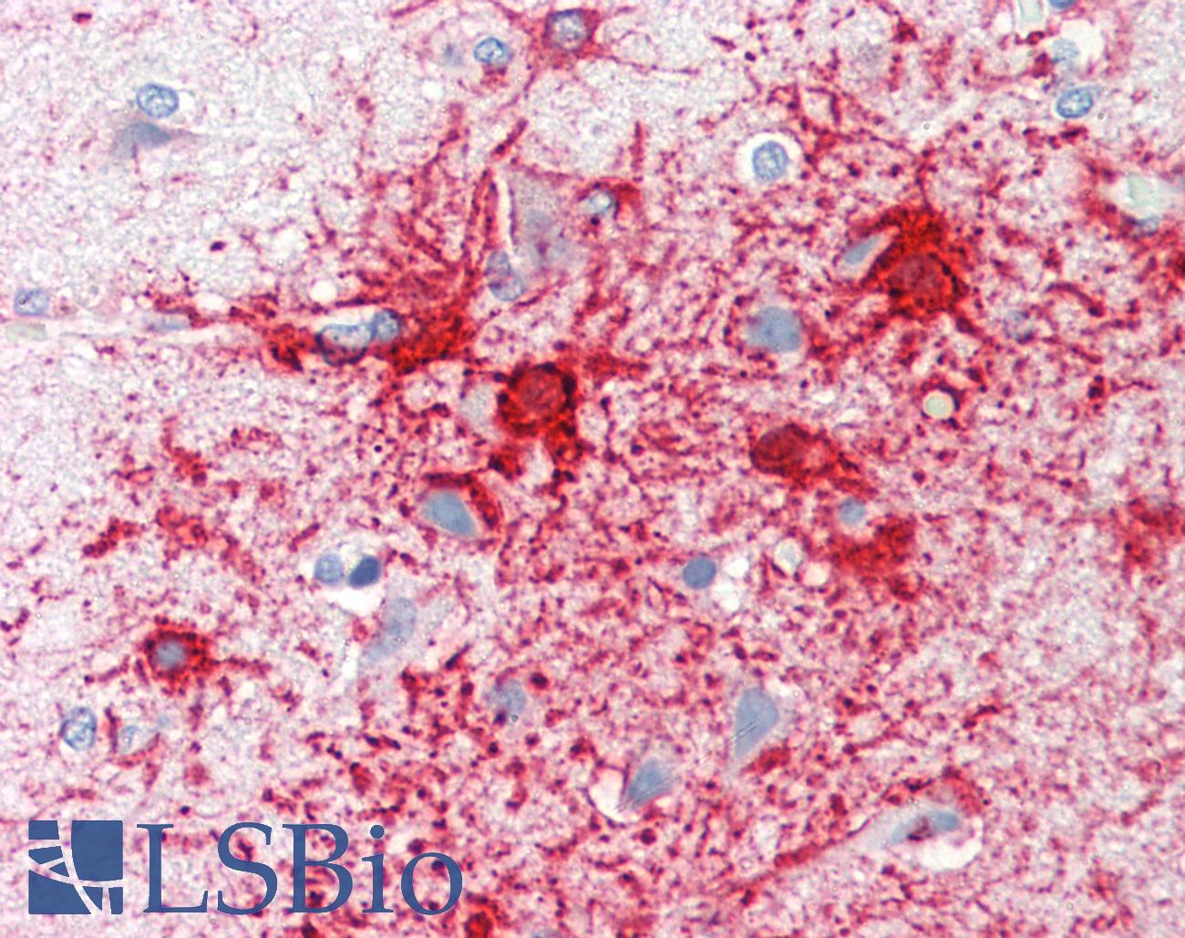ADCY1 / Adenylate Cyclase 1 Antibody - Anti-ADCY1 / Adenylate Cyclase 1 antibody IHC staining of human brain, cortex. Immunohistochemistry of formalin-fixed, paraffin-embedded tissue after heat-induced antigen retrieval. Antibody dilution 1:100.