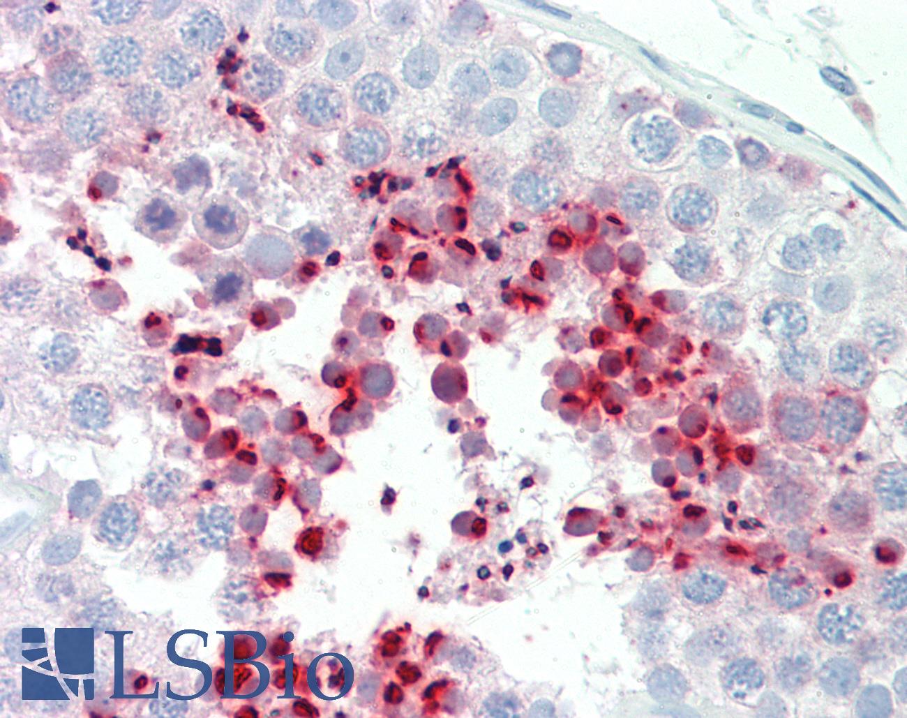 ADCY1 / Adenylate Cyclase 1 Antibody - Huma Testis: Formalin-Fixed, Paraffin-Embedded (FFPE)