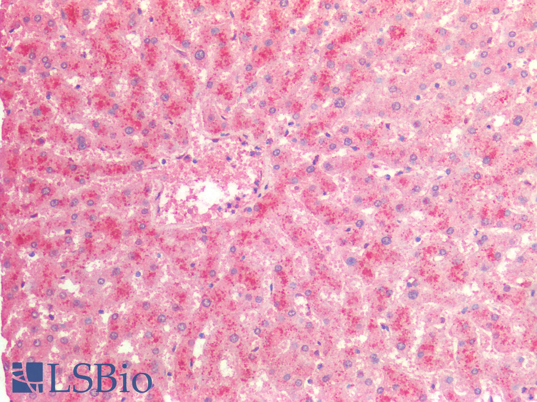 ADCY3 / Adenylate Cyclase 3 Antibody - Human Liver: Formalin-Fixed, Paraffin-Embedded (FFPE)