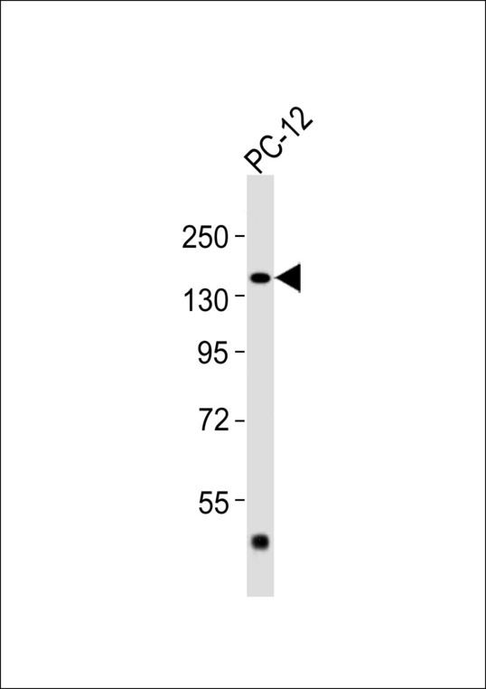ADCY5 / Adenylate Cyclase 5 Antibody - Anti-Adenylate Cyclase 5/6 Antibody at 1:1000 dilution + PC-12 whole cell lysates Lysates/proteins at 20 ug per lane. Secondary Goat Anti-Rabbit IgG, (H+L),Peroxidase conjugated at 1/10000 dilution Predicted band size : 139 kDa Blocking/Dilution buffer: 5% NFDM/TBST.
