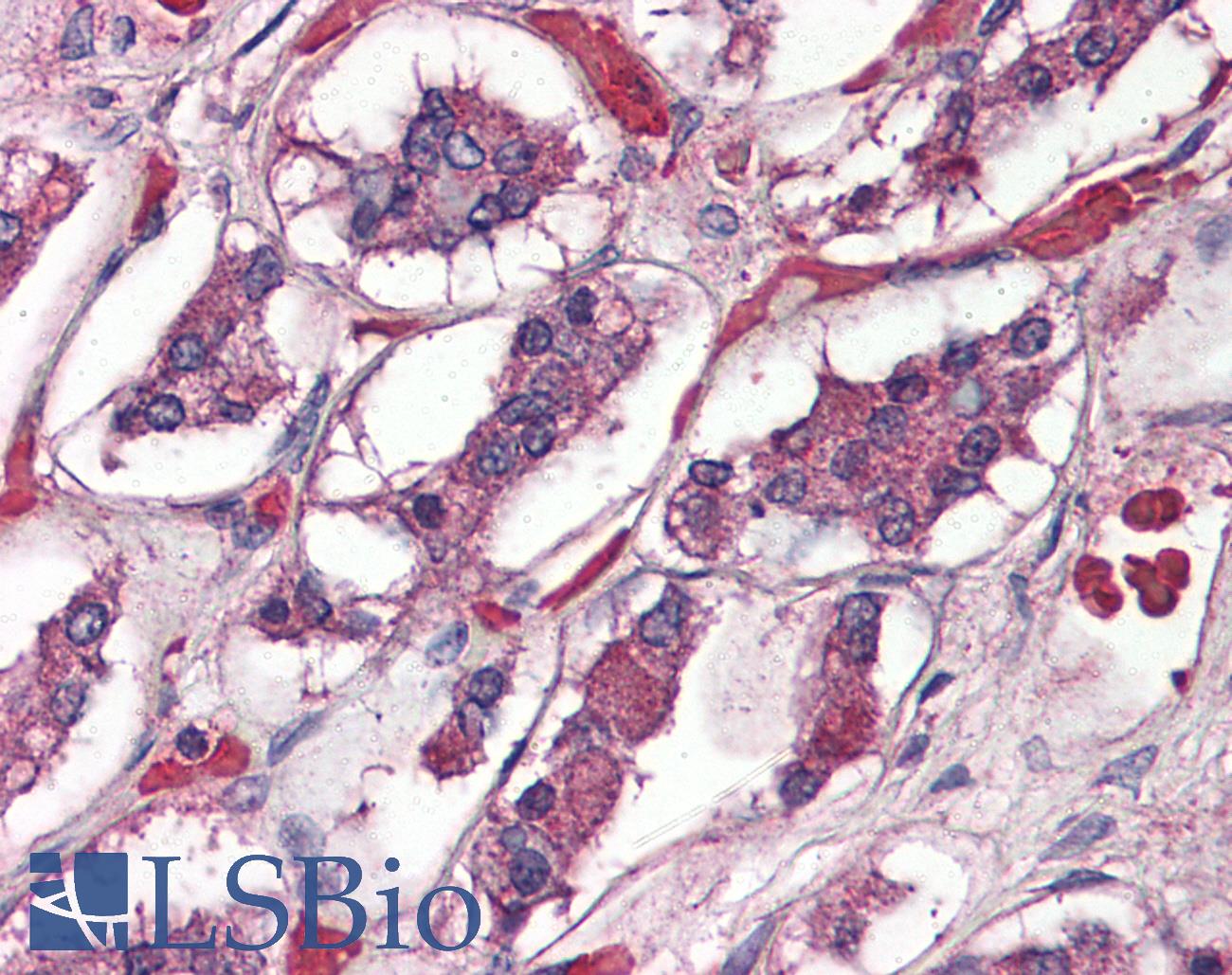 ADCYAP1R1 / PAC1 Receptor Antibody - Anti-ADCYAP1R1 / PAC1 Receptor antibody IHC of human brain, pituitary. Immunohistochemistry of formalin-fixed, paraffin-embedded tissue after heat-induced antigen retrieval.