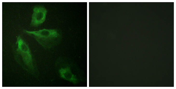 ADD1 / Adducin Alpha Antibody - Immunofluorescence analysis of HeLa cells, using ADD1 Antibody. The picture on the right is blocked with the synthesized peptide.