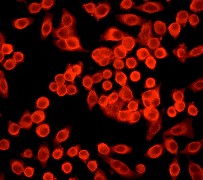 ADD1 / Adducin Alpha Antibody - Immunofluorescent staining of HeLa using anti-Adducin antibody (C-term).
