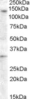 ADGRA3 / GPR125 Antibody - ADGRA3 / GPR125 antibody (0.5µg/ml) staining of Human Ovary lysate (35µg protein in RIPA buffer). Detected by chemiluminescence.