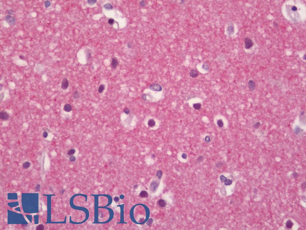 ADGRB1 / BAI1 Antibody - Human Brain, Cortex: Formalin-Fixed, Paraffin-Embedded (FFPE)