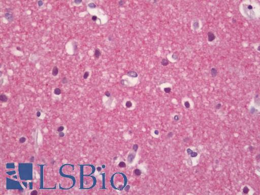 ADGRB1 / BAI1 Antibody - Human Brain, Cortex: Formalin-Fixed, Paraffin-Embedded (FFPE)