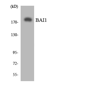 ADGRB1 / BAI1 Antibody - Western blot analysis of the lysates from HUVECcells using BAI1 antibody.