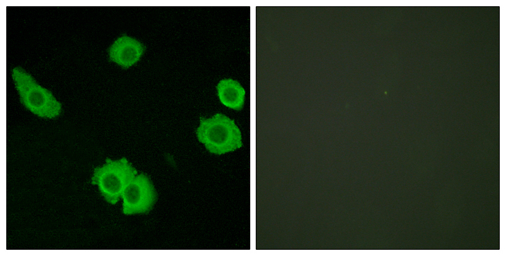 ADGRB3 / BAI3 Antibody - Immunofluorescence analysis of HUVEC cells, using BAI3 Antibody. The picture on the right is blocked with the synthesized peptide.