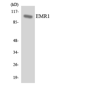 ADGRE1 / EMR1 Antibody - Western blot analysis of the lysates from HUVECcells using EMR1 antibody.