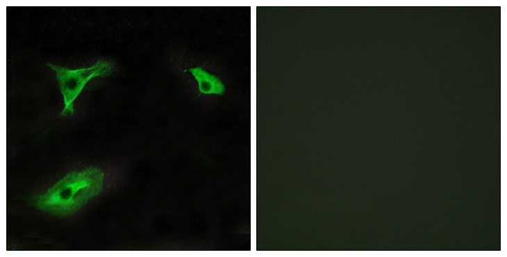 ADGRF5 / GPR116 Antibody - Immunofluorescence analysis of HeLa cells, using GPR116 Antibody. The picture on the right is blocked with the synthesized peptide.