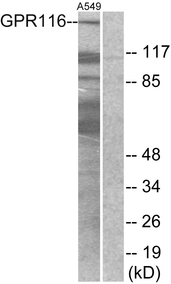 ADGRF5 / GPR116 Antibody - Western blot analysis of lysates from A549 cells, using GPR116 Antibody. The lane on the right is blocked with the synthesized peptide.
