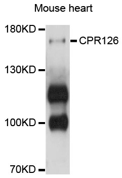ADGRG6 / GPR126 Antibody - Western blot analysis of extracts of mouse heart, using GPR126 antibody at 1:1000 dilution. The secondary antibody used was an HRP Goat Anti-Rabbit IgG (H+L) at 1:10000 dilution. Lysates were loaded 25ug per lane and 3% nonfat dry milk in TBST was used for blocking. An ECL Kit was used for detection and the exposure time was 5s.