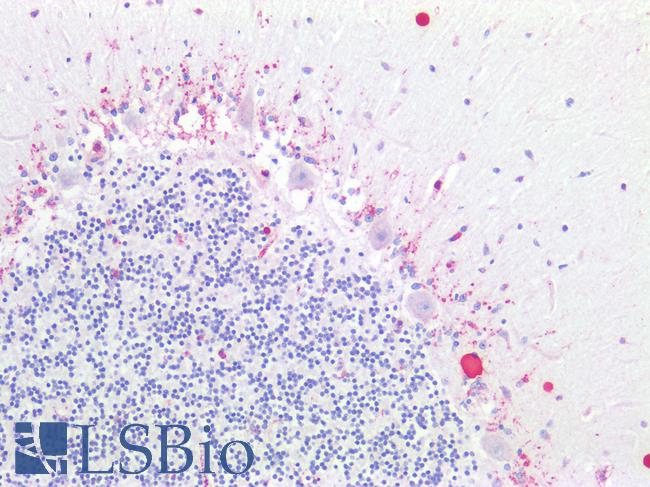 ADGRL1 / LPHN1 Antibody - Human Brain, Cerebellum: Formalin-Fixed, Paraffin-Embedded (FFPE)
