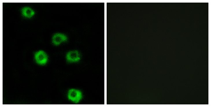 ADGRL2 / LPHN2 Antibody - Immunofluorescence analysis of COS7 cells, using LPHN2 Antibody. The picture on the right is blocked with the synthesized peptide.