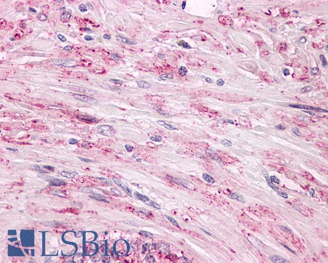 ADGRL2 / LPHN2 Antibody - Anti-LPHN2 / Latrophilin-2 antibody IHC of human prostate, smooth muscle, benign prostatic hyperplasia. Immunohistochemistry of formalin-fixed, paraffin-embedded tissue after heat-induced antigen retrieval.