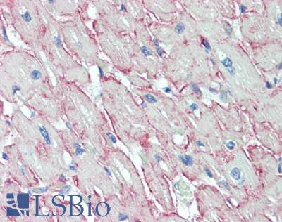 ADGRL4 / ELTD1 Antibody - Human Heart: Formalin-Fixed, Paraffin-Embedded (FFPE), at a concentration of 5 ug/ml.