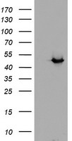 ADH7 Antibody - HEK293T cells were transfected with the pCMV6-ENTRY control (Left lane) or pCMV6-ENTRY ADH7 (Right lane) cDNA for 48 hrs and lysed. Equivalent amounts of cell lysates (5 ug per lane) were separated by SDS-PAGE and immunoblotted with anti-ADH7. At a dilution of 1:2000.