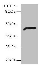 ADH7 Antibody - Western blot All lanes: ADH7 antibody at 2µg/ml + Mouse liver tissue Secondary Goat polyclonal to rabbit IgG at 1/10000 dilution Predicted band size: 42, 43 kDa Observed band size: 42 kDa