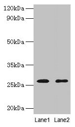 Adiponectin Antibody - Western blot All lanes: Adiponectin antibody at 2µg/ml Lane 1: Human NIH/3T3 whole cell lysate Lane 2: Human HL60 whole cell lysate Secondary Goat polyclonal to rabbit IgG at 1/10000 dilution Predicted band size: 26 kDa Observed band size: 26 kDa