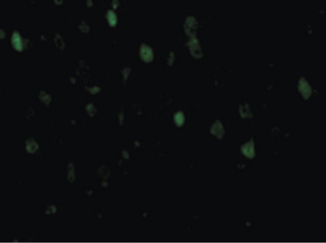 Adiponectin Antibody - Immunofluorescence of Adiponectin in Rat Brain cells with Adiponectin antibody at 10 ug/ml.