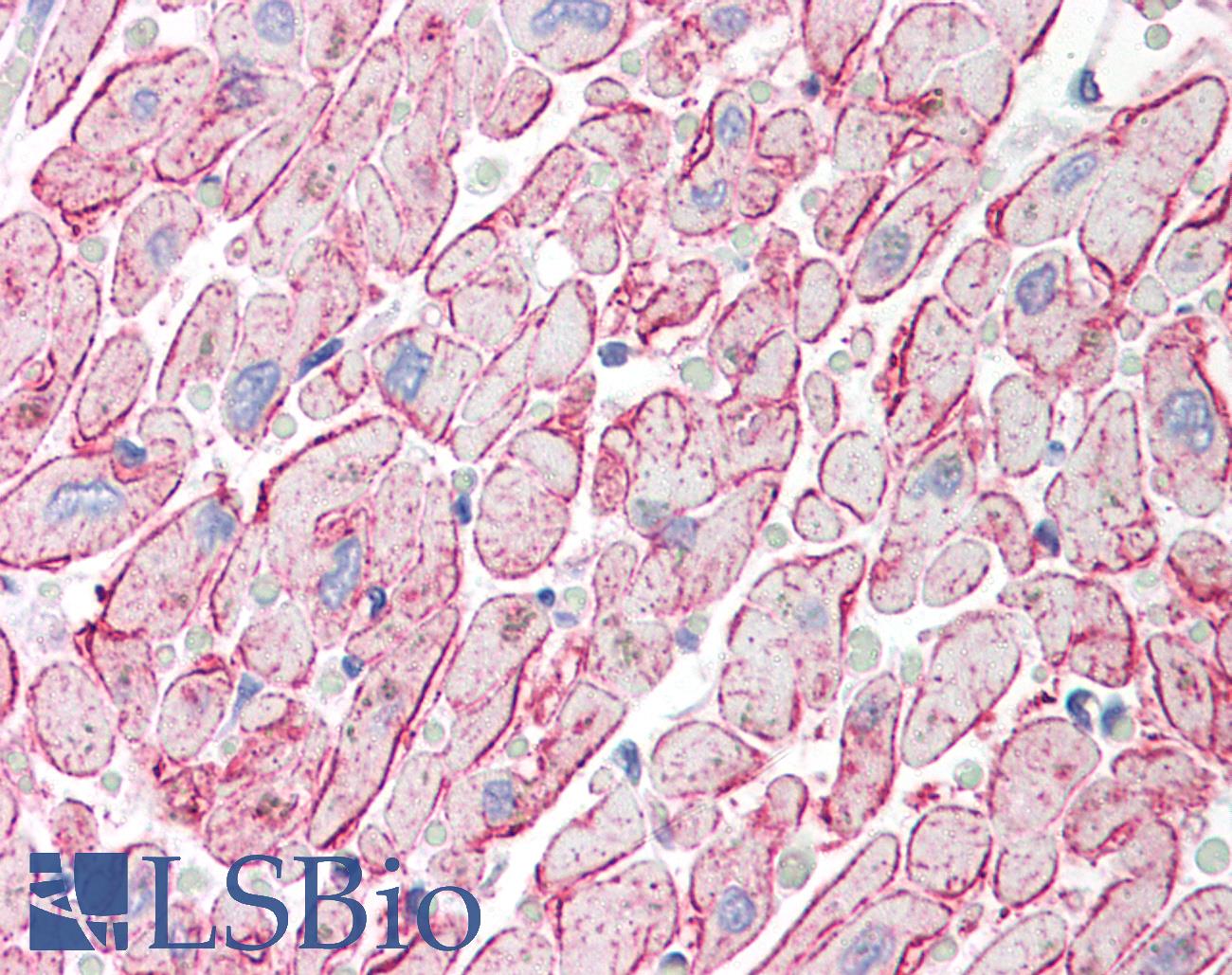 Adiponectin Antibody - Anti-Adiponectin antibody IHC of human heart. Immunohistochemistry of formalin-fixed, paraffin-embedded tissue after heat-induced antigen retrieval. Antibody concentration 5 ug/ml.