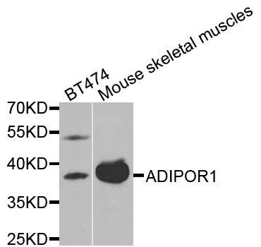 ADIPOR1/Adiponectin Receptor 1 Antibody - Western blot analysis of extracts of various cell lines, using ADIPOR1 antibody at 1:1000 dilution. The secondary antibody used was an HRP Goat Anti-Rabbit IgG (H+L) at 1:10000 dilution. Lysates were loaded 25ug per lane and 3% nonfat dry milk in TBST was used for blocking.