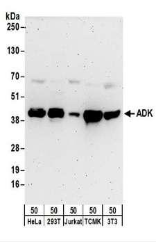ADK / Adenosine Kinase Antibody - Detection of Human and Mouse ADK by Western Blot. Samples: Whole cell lysate (50 ug) from HeLa, 293T, Jurkat, mouse TCMK-1, and mouse NIH3T3 cells. Antibodies: Affinity purified rabbit anti-ADK antibody used for WB at 0.1 ug/ml. Detection: Chemiluminescence with an exposure time of 3 minutes.